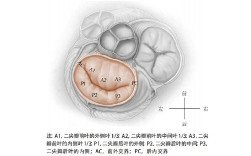 醫(yī)療器械備案注冊代辦—經(jīng)導(dǎo)管二尖瓣夾系統(tǒng)臨床評價審評概述及審評關(guān)注點